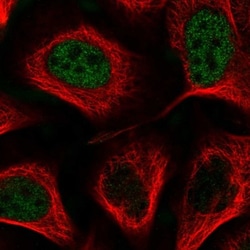 MIDN Antibody, Novus Biologicals 25 &mu;L, Unlabeled:Antibodies, Polyclonal